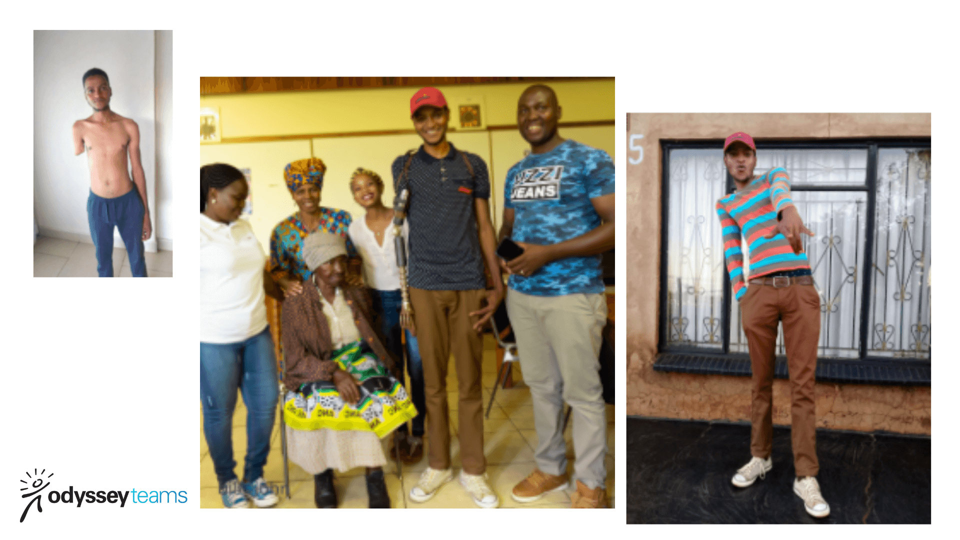 Group fitting prosthetic hands through Build-A-Hand® Program in South Africa with recipients and family