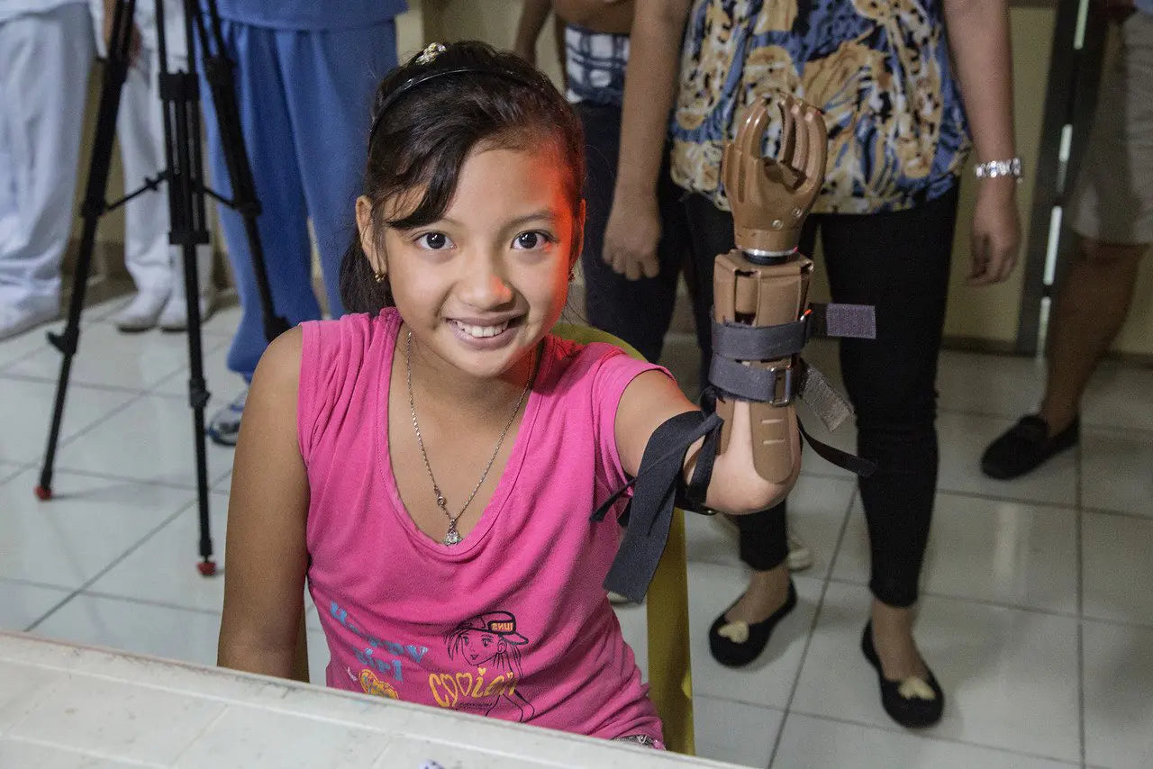 Build-A-Hand in Action: How Teamwork Helped Deliver 302 Prosthetic Hands in July 2026
